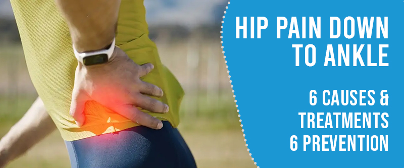 6 Causes and Treatments of Hip Pain Down To The Ankles [6 Preventions]