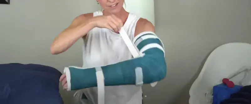 How Long Does A Broken Arm Take To Heal: 6 Factors [Influences]