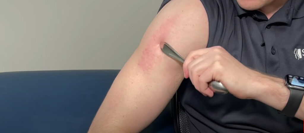 14 Real Reasons and Effective Home Remedies for Weak Arms