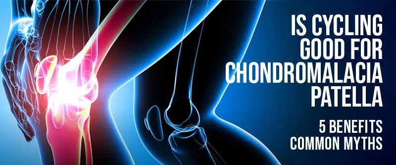 5 Benefits & Precautions of Cycling for Chondromalacia Patella