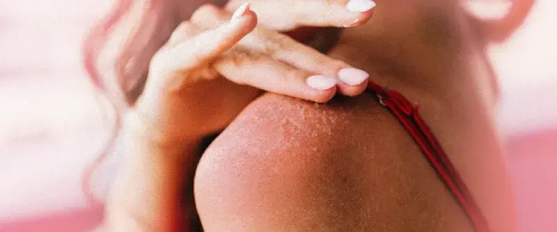 7 Reasons Not To Peel A Sunburn Before Cycling