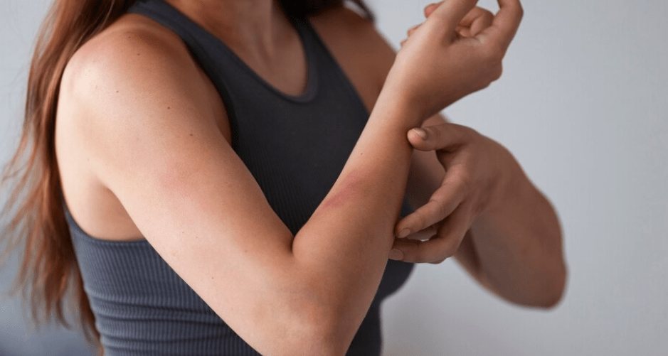 4 Precautions for Cyclists Using Aloe Vera