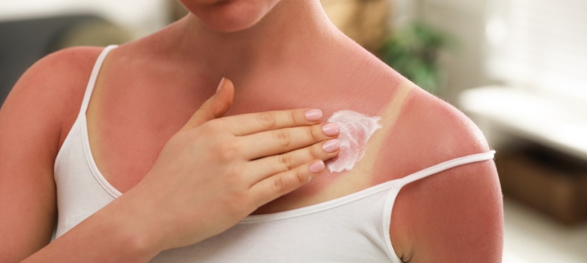 Benefits and Risks Of Vitamin E For Cyclists With Sunburn