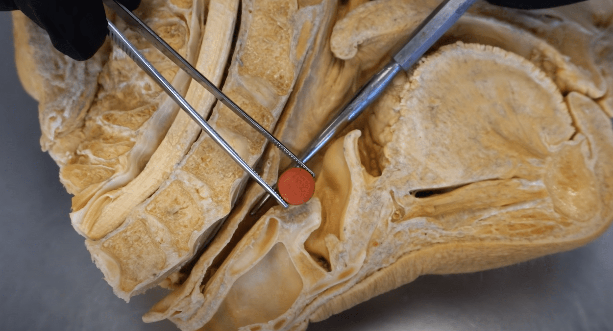 10 Practical Ways to Use Ibuprofen for Sunburn