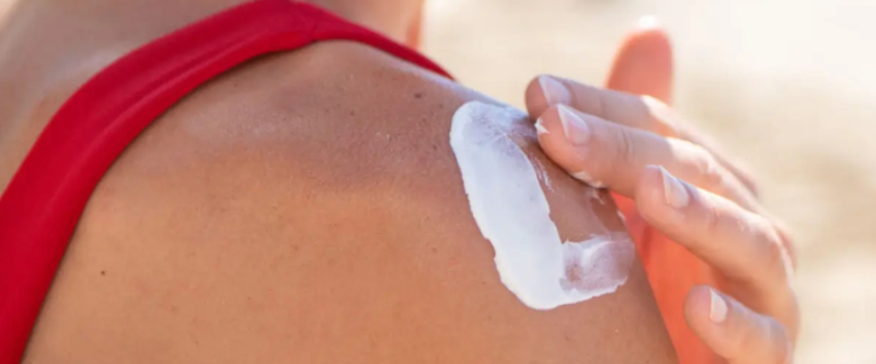 10 Pros & Cons, 10 Best Ways[5 Precautions] of Noxzema for Sunburn After Cycling
