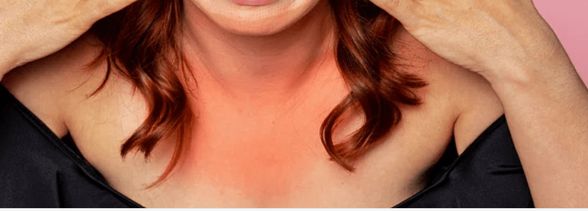 The pros and cons of vinegar for sunburn