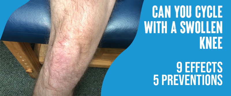 A close-up of a swollen and inflamed knee joint