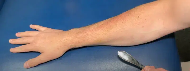 A cyclist demonstrating a relaxed grip on the handlebars