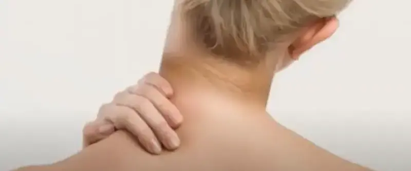 A cyclist with a dark, hyperpigmented neck from sun exposure