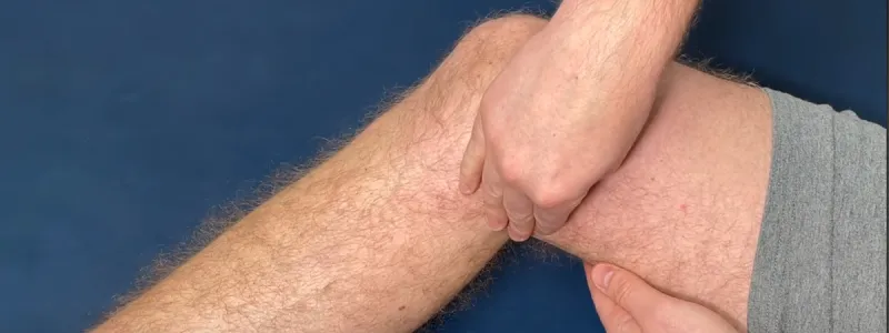 A swollen knee joint after a long bike ride