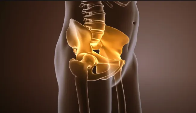 An MRI scan showing a torn labrum in the hip