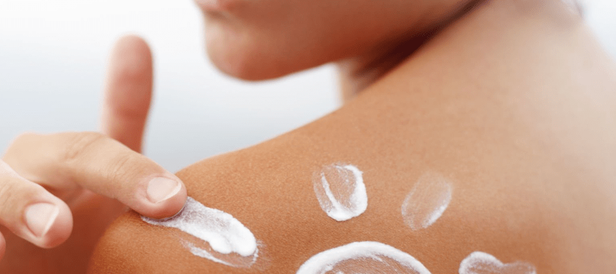 Gently applying Noxzema cream to sunburned skin