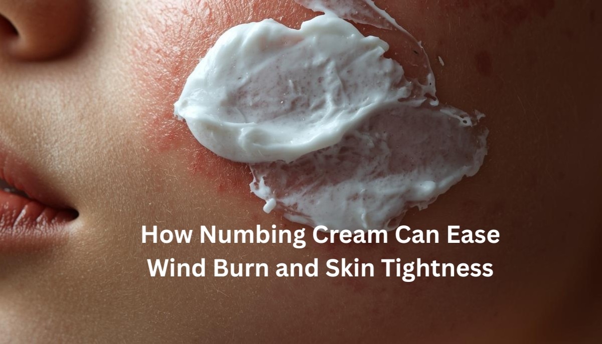 Applying numbing cream for windburn relief